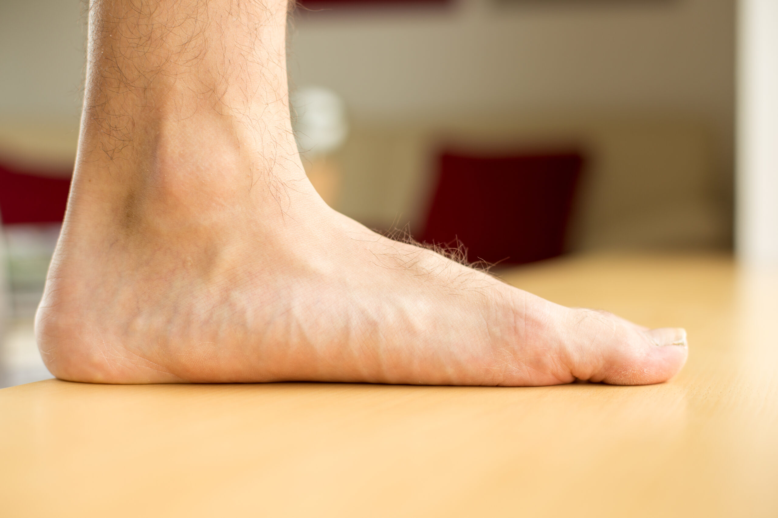 Flat feet