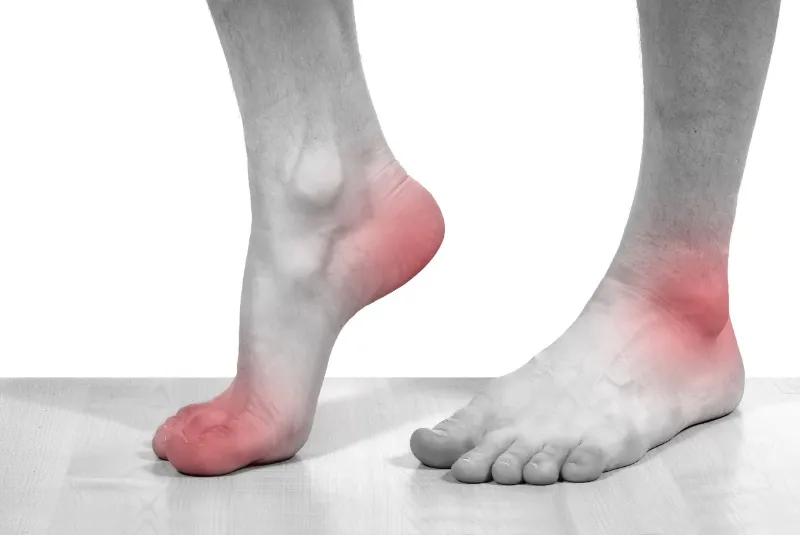 Other foot and ankle conditions treated by Dr. Barber